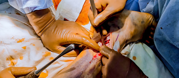 MANEJO DEL TRAUMA EN URGENCIAS ¿QUÉ HAY DE NUEVO?, XIX Simposio Internacional de Emergencias Médicas y paciente Crítico (SIEMPAC) - 2021. (00148)